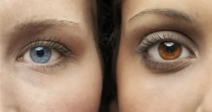 Éclaircissement laser de l'iris-latisse gouttes changeantes de couleur des yeux