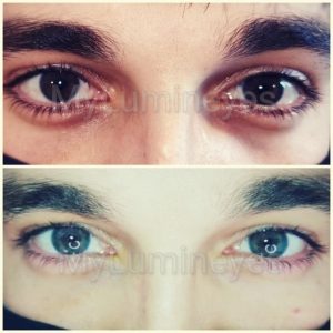 Vorher-Nachher-Fotos ändern die Augenfarbe