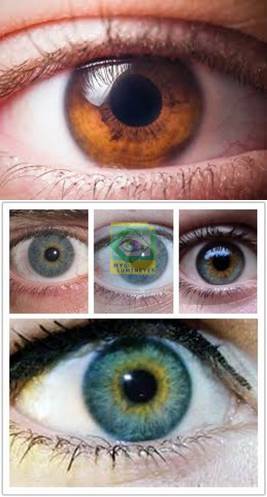 Before And After Photos Of Laser Eye Color Change Surgery