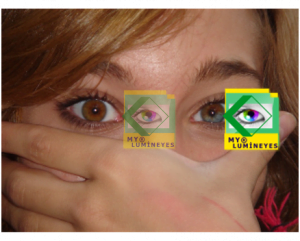 eye-color-change-laser-mylumineyes