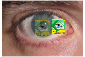 eye color change laser mylumineyes4