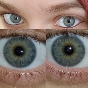 laser eye color change operation