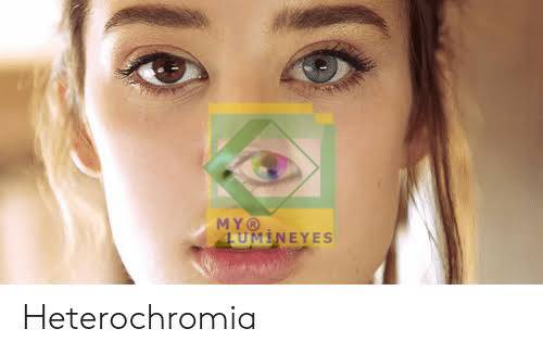 heterochromia laser eye color change