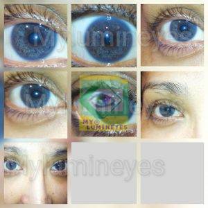 eye color change laser mylumineyes