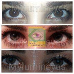 Cambio de color de ojos con láser antes y después