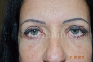 eye color change turkey