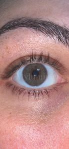 best laser eye color change  prices where