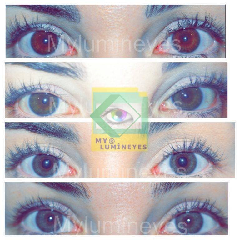 MYlumineyes Laser Eye Color Change Center Lumineyes Laser Eye Color