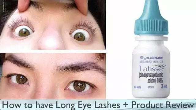 latisse eye discoloration