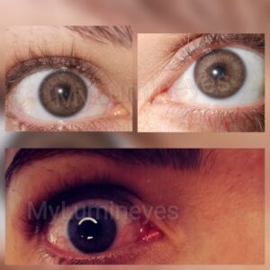 EYE-COLOR-CHANİNG-PRİCES-CENTERS-PHOTOS-BEST