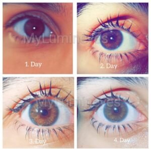 brown-to-green-laser-eye-color-change