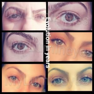 best-doctor-for-eye-color-change