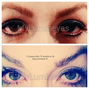 brown-green-lighting-laser-eye-color-change