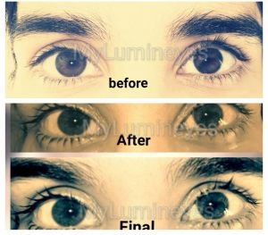 grade-4-blue-green-grey-eye-color-change