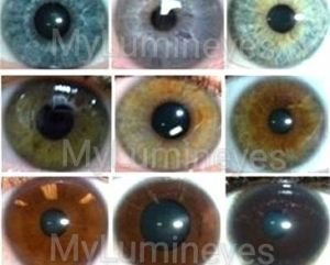 istanbul-eye-color-changing-center