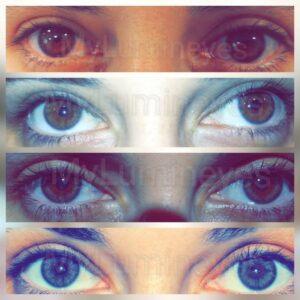 barcelona-eyecos-istanbul-mexico-yeux-laser-eye-color-change-best-center-mylumineyes