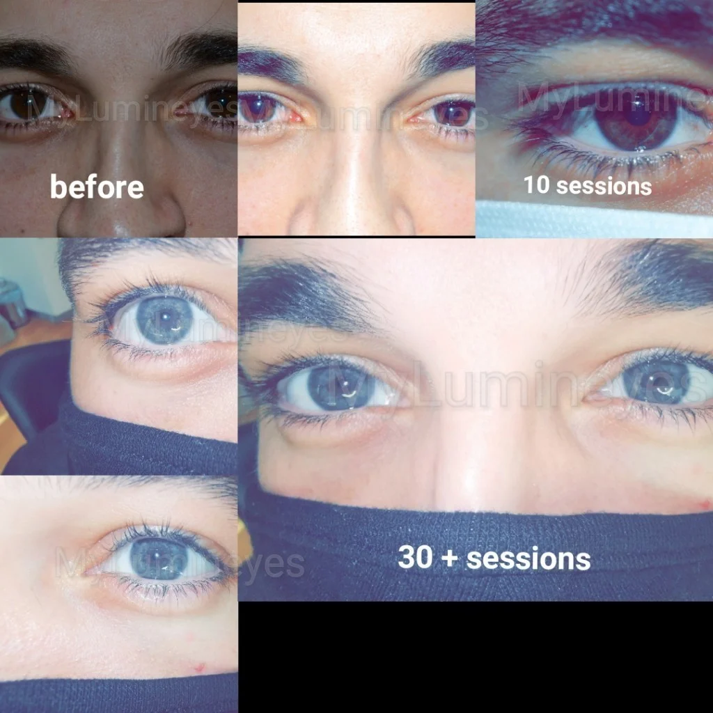 brown to green eye color change