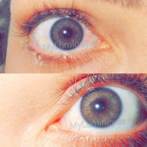Eye-colour-changes-by-laser-lumineyes