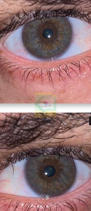 best-eye-color-change-hospital-doctor