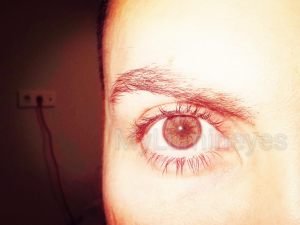 brown-eyes-lightening-mylumineyes
