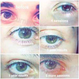 brown-to-green-blue-eyes