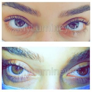 laser-eye-color-change-prices-mexico-barcelona-istanbul