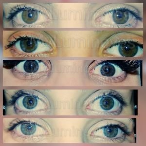 light-brown-eyes-to-blue-laser-color-change