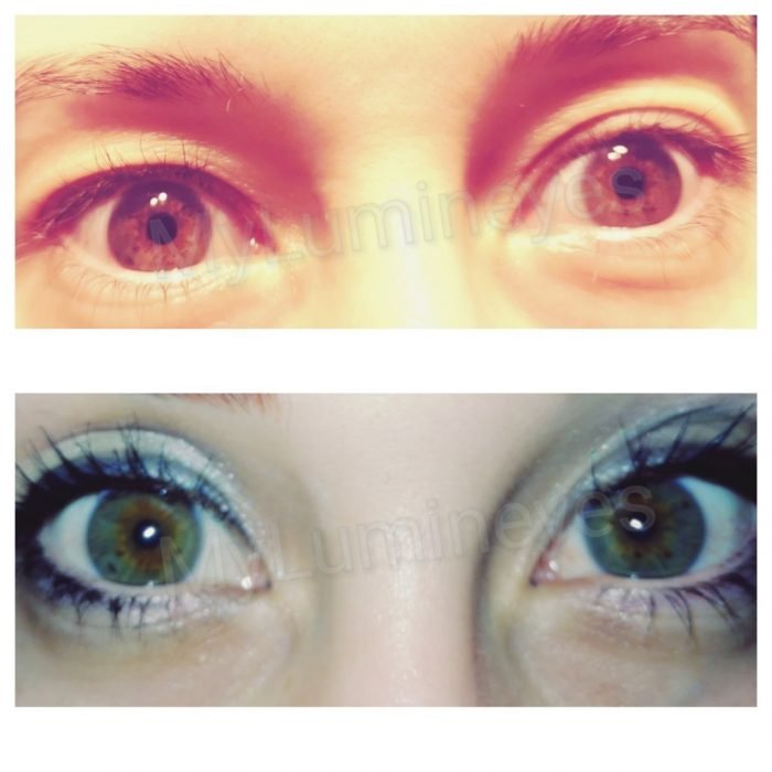 Eye Color Change Risks and Safe Eye Color Change Naturally