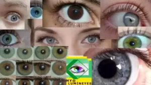 eye color change surgery archives