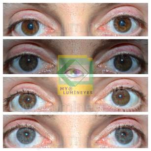 Cambiamento sicuro del colore degli occhi in modo naturale