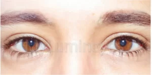 changing your iris color