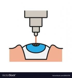 lasik-laser-eye-surgery-vision-istanbul-best