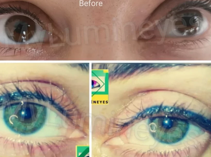 safe-eye-color-changing-quick-effective