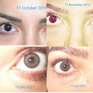 how to change your eye color 1 5