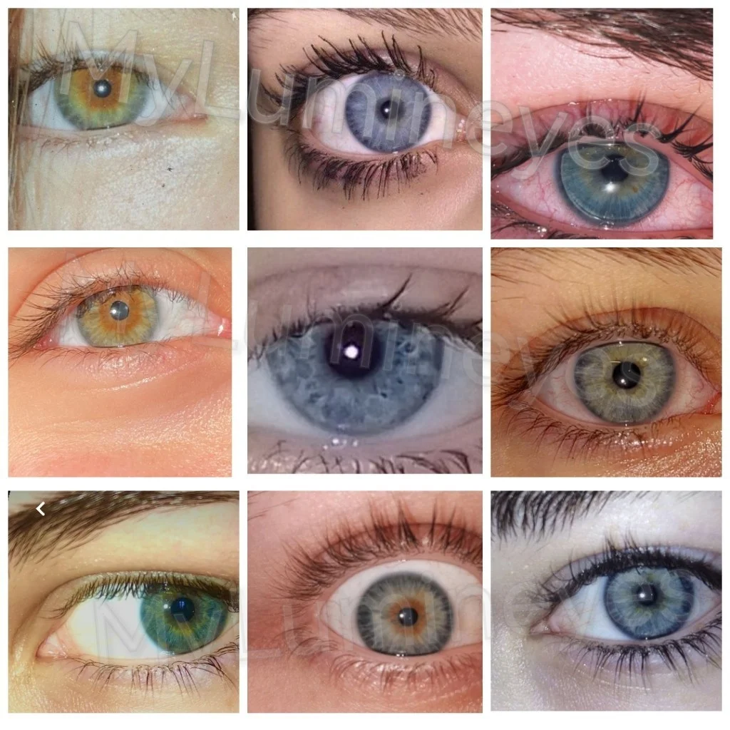 eye color change costs istanbul