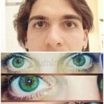 permanent eye color change before-after