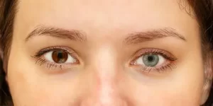 les yeux peuvent-ils changer de couleur avec le laser
