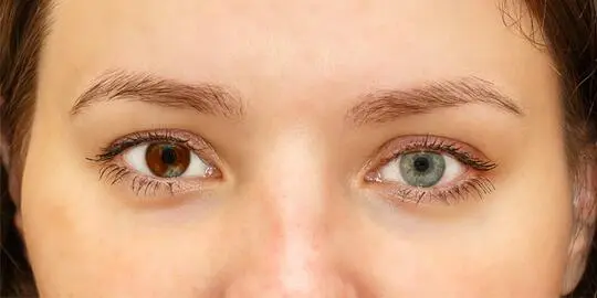 can eyes change color with laser