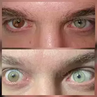 can you change your eyes color-eye color changing