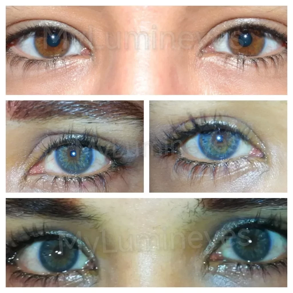 cosa causa il cambiamento del colore degli occhi negli adulti e gli occhi belli/colore più raro