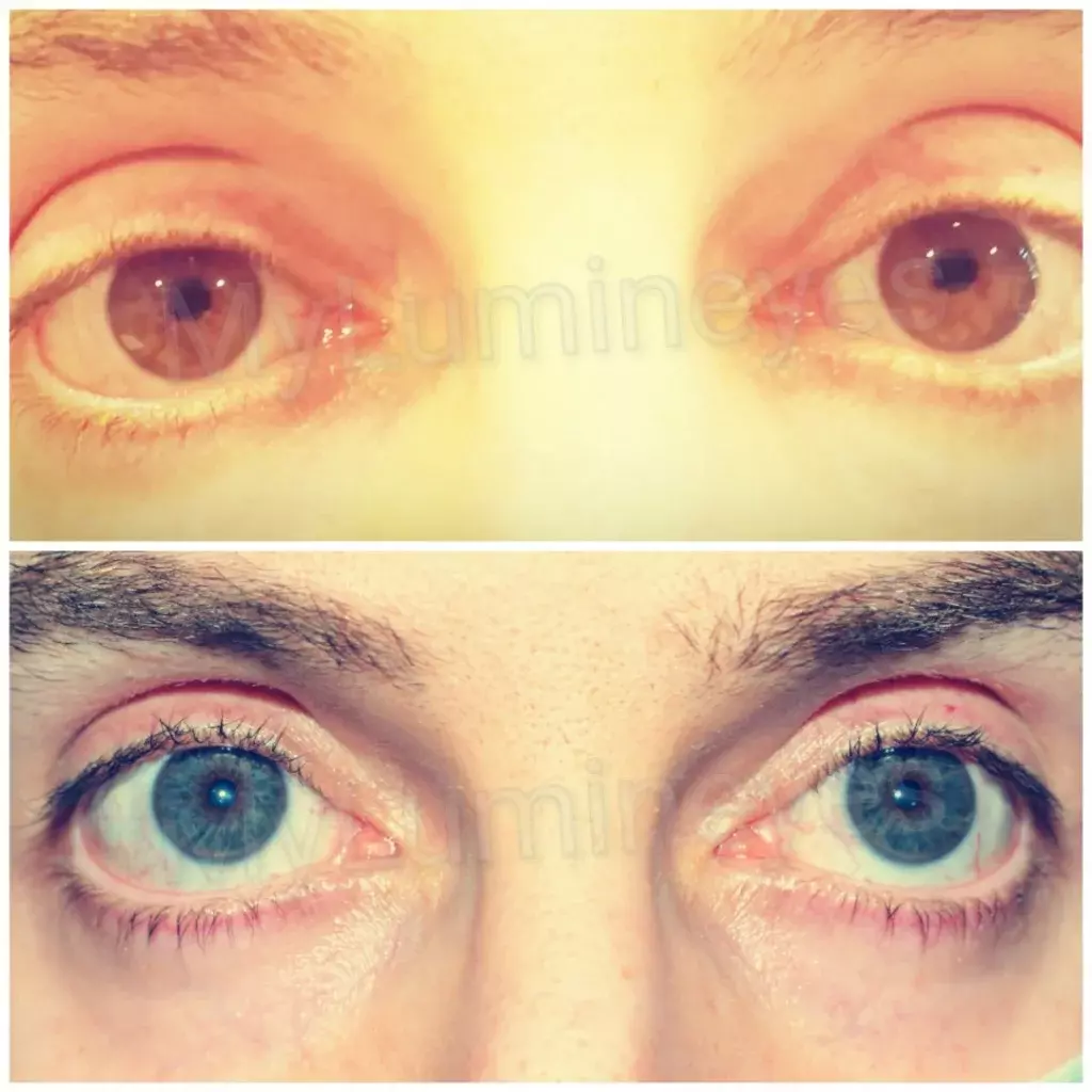 successful effective eye color change