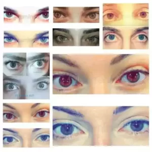 changing eye color with laser