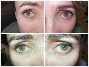 can you change your eye color?