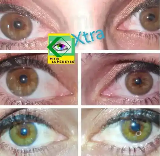 Laser mit wechselnder Augenfarbe