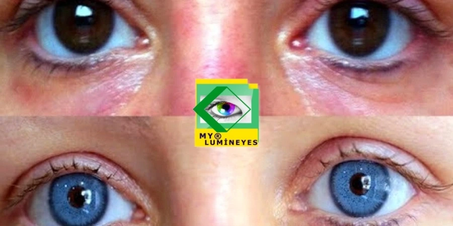 Cambiar color de ojos y lentes de contacto