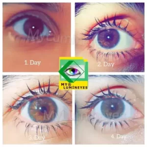 самый редкий хирургический лазер для изменения цвета глаз