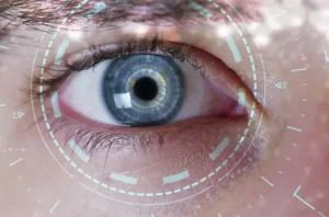 laser-eye-surgery-heterochromia-color