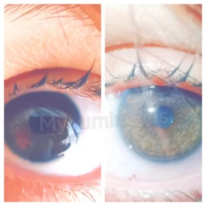 Änderung der Augenfarbe von braun zu haselnussbraun