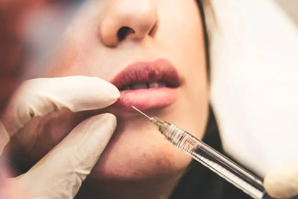 botox and filler,botox vs filler,lip filler and risks near me