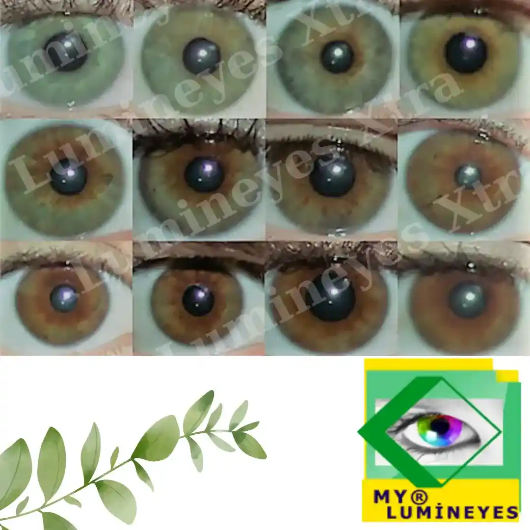 Lumineyes Xtra laser eye color change before after